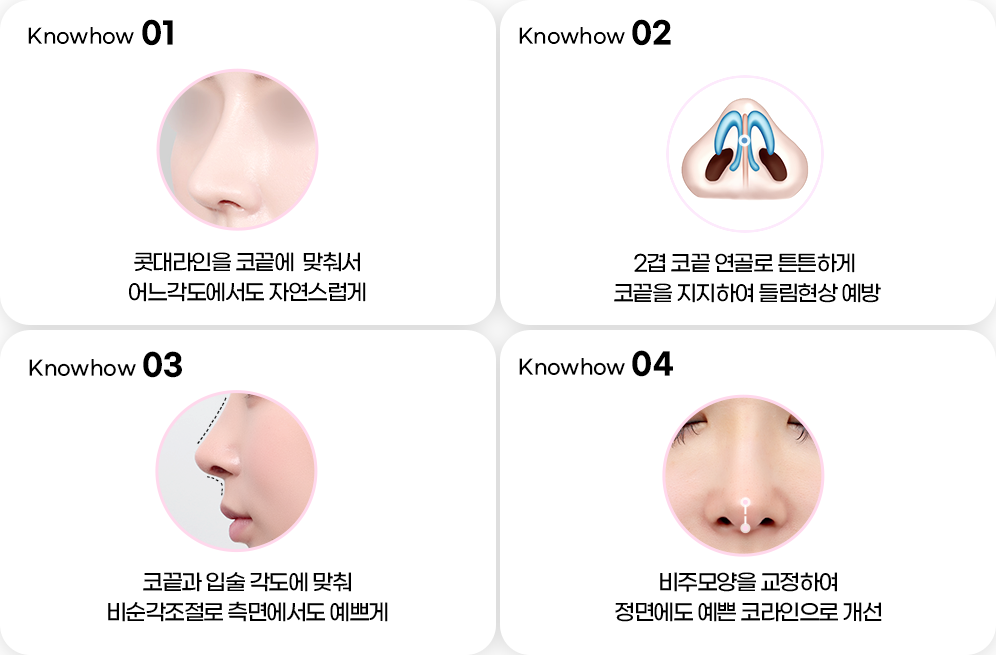 디에이 비염미용코성형