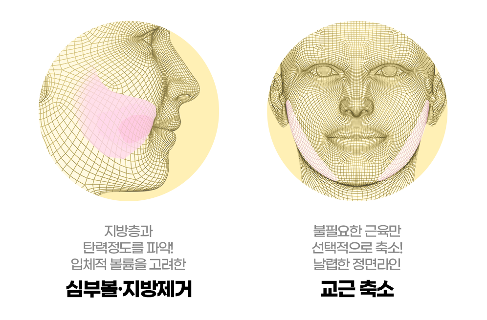 디에이 윤곽2종