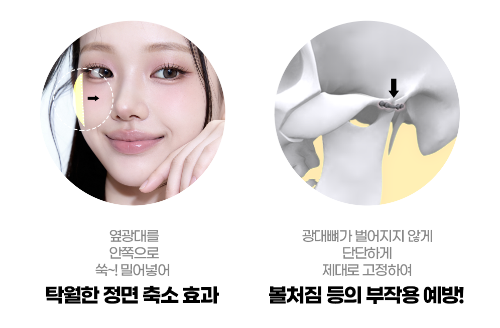 디에이 윤곽2종