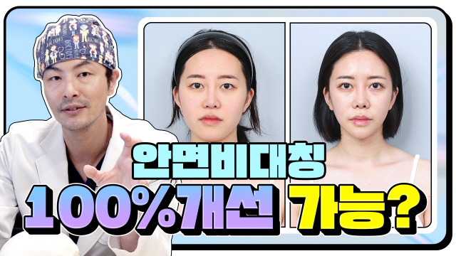 안면비대칭 100% 개선 가능?