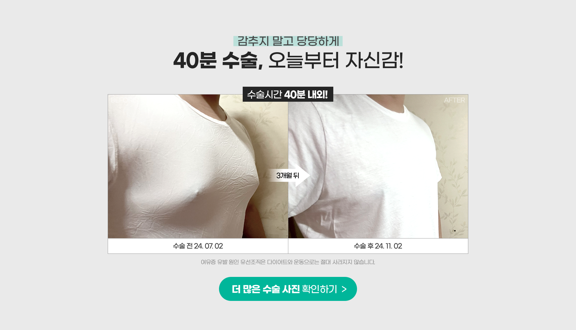 감추지 말고 당당하게 40분 수술, 오늘부터 자신감 / BEFORE > AFTER