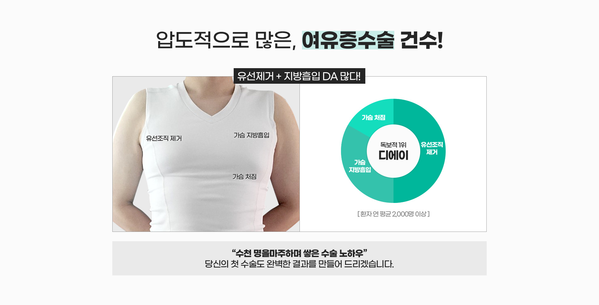 압도적으로 많은, 여유증수술 건수!