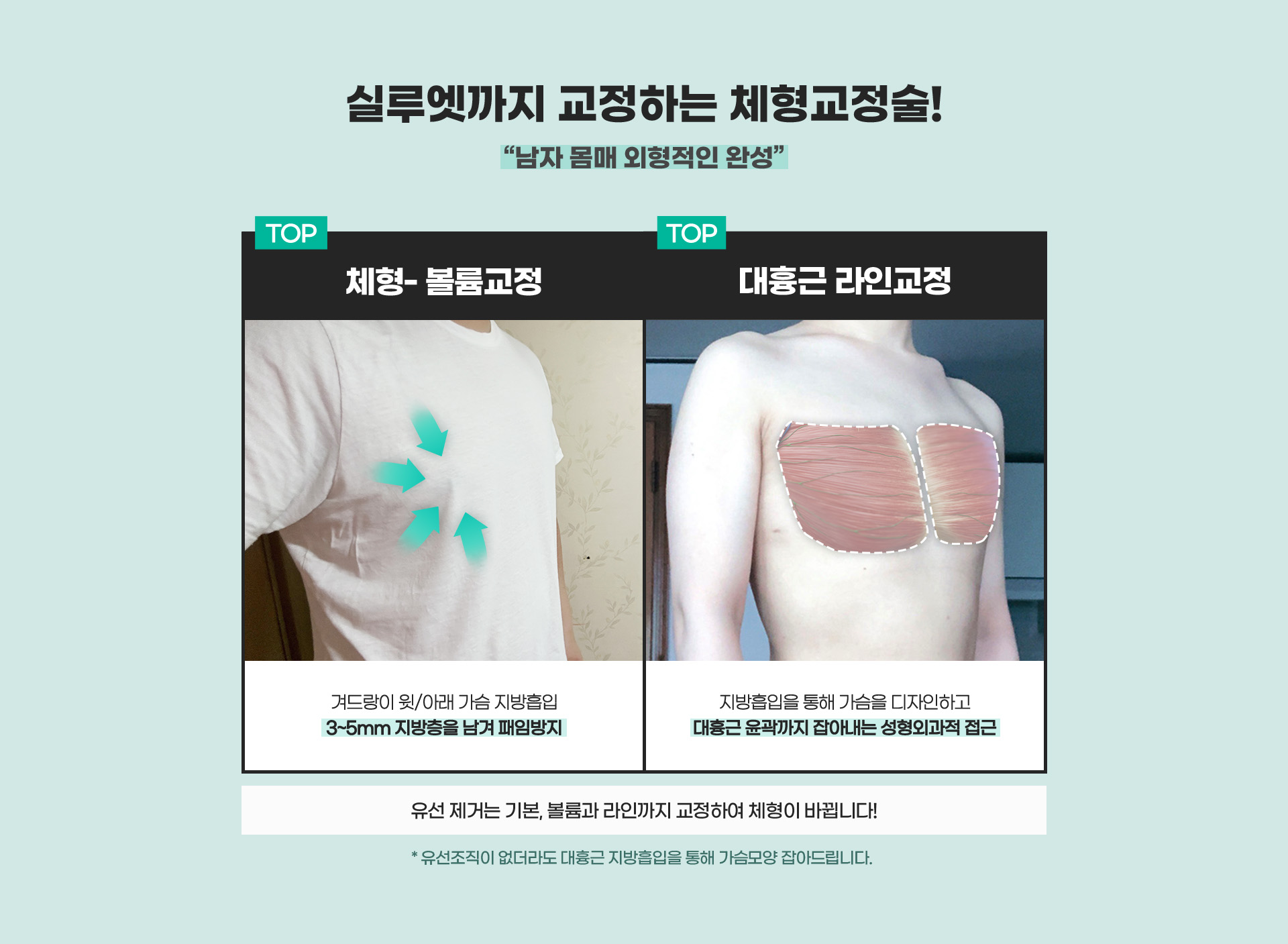 실루엣까지 교정하는 체형교정술! 남자 몸매 외형적인 완성