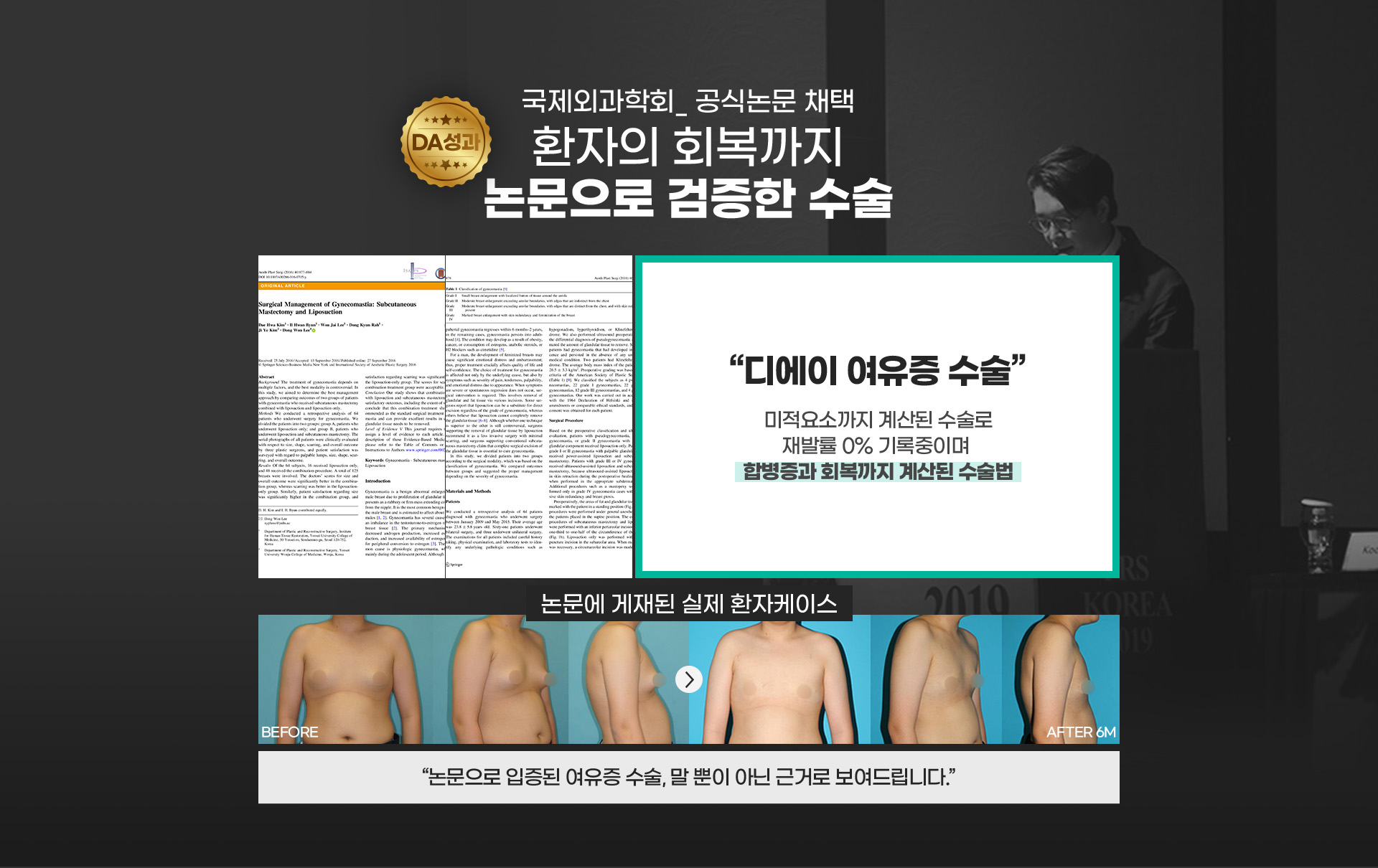 국제외과학회_ 공식논문 채택 환자의 회복까지 논문으로 검증한 수술