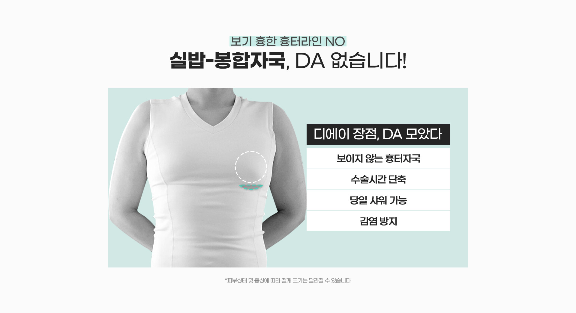 보기 흉한 흉터라인 NO , 실밥-봉합자국, Da 없습니다!