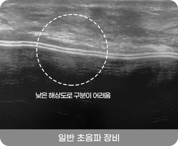 디에이 유방정밀검진