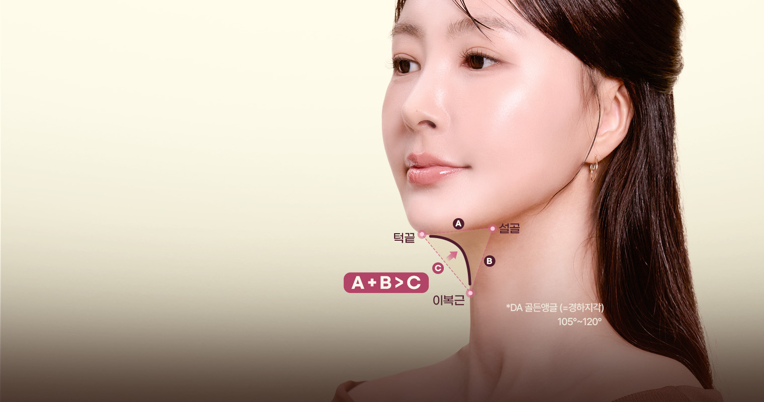 디에이 이중턱 삭제술