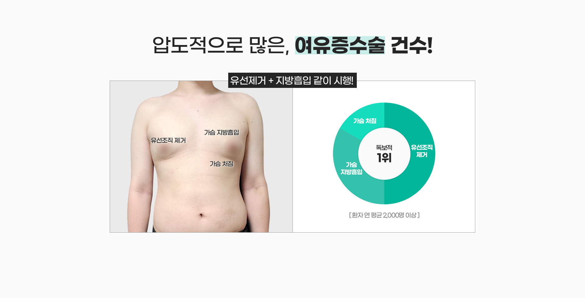 압도적으로 많은, 여유증수술 건수