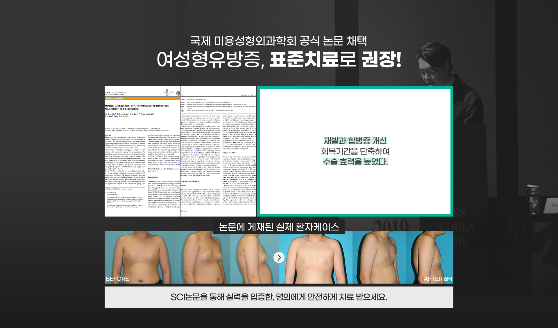국제 미용성형외과학회 공식 논문 채택 여성형유방증, 표준치료로 권장