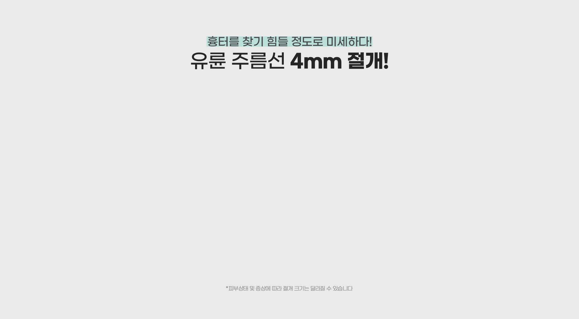 흉터를 찾기 힘들 정도로 미세하다! 유륜 주름선 4mm 절개법!