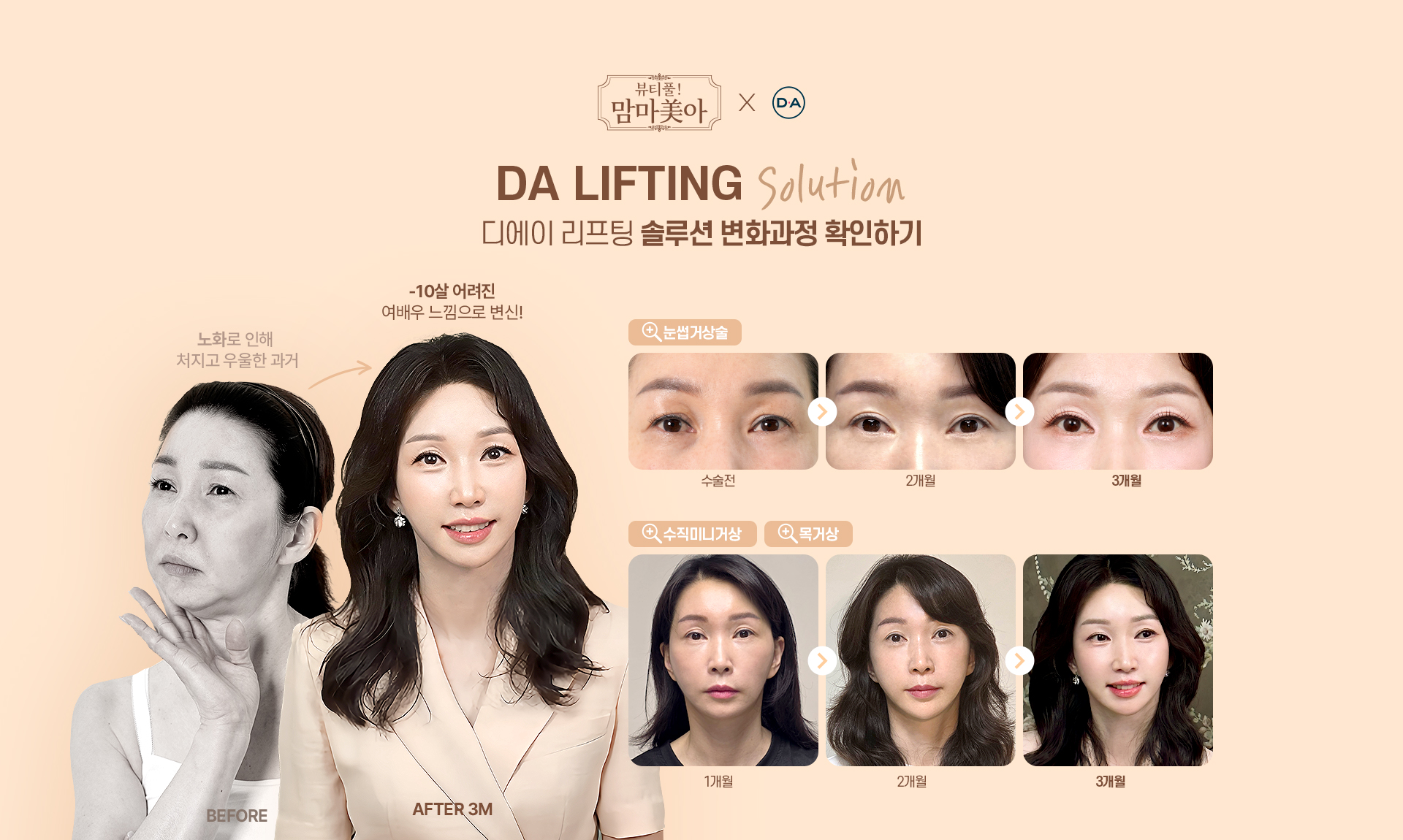 뷰티풀! 맘마美아