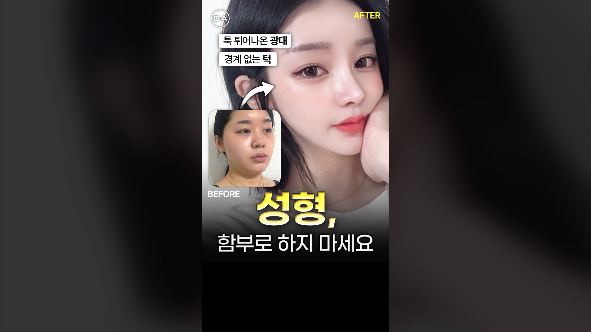 윤곽+눈+코
