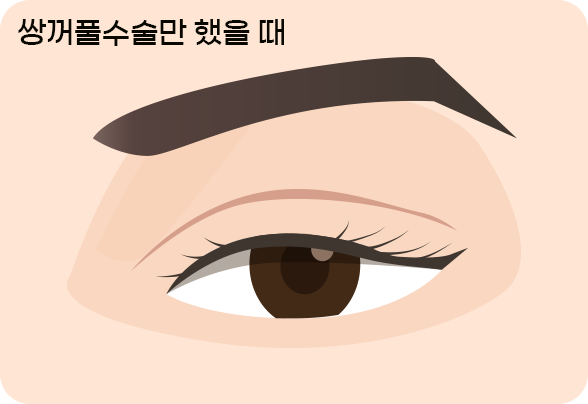 이미지 제목