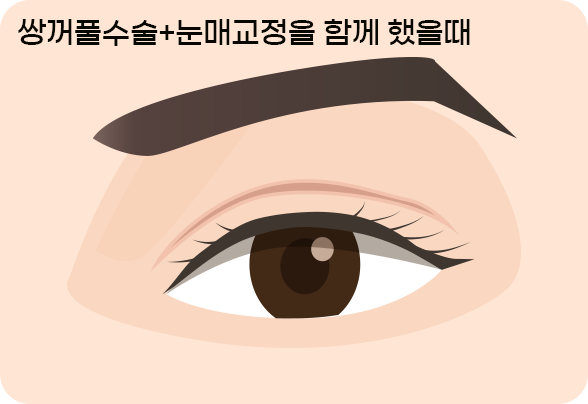 이미지 제목