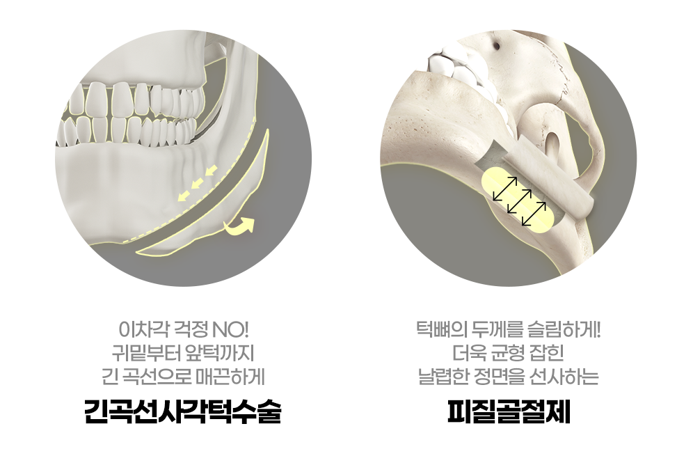 이미지 제목