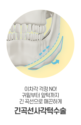 윤곽 3종